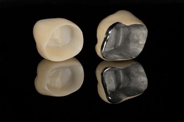 dental crowns