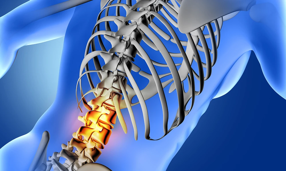 6 Signs a Lumbar Spine Fracture Needs Medical Attention